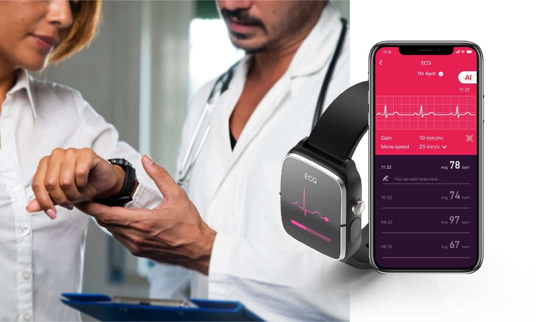 Ecg features